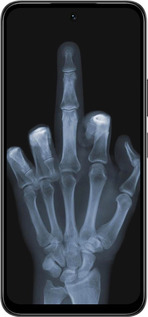 Силіконовий чехол Рука через рентген для Infinix Smart 10 PLus - 1007u-4108 изображение 