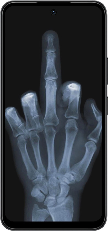 Силиконовый чехол Рука через рентген для Infinix Smart 10 - 1007u-4104 изображение 