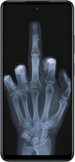 Силиконовый чехол Рука через рентген для Infinix Smart 8 Plus - 1007u-3677 изображение 