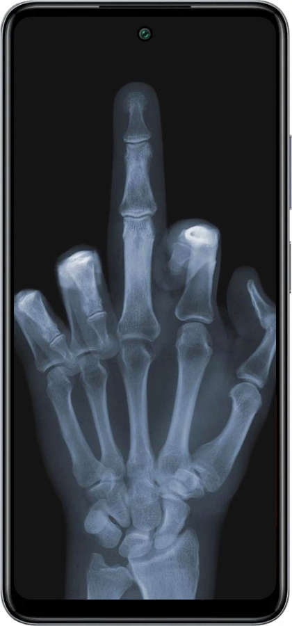 Силиконовый чехол Рука через рентген для Infinix Smart 8 Plus - 1007u-3677 изображение 