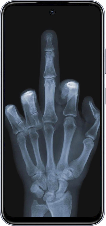 TPU чехол Рука через рентген для Infinix Smart 9 - 1007b-3809 изображение 