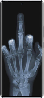 Силиконовый чехол Рука через рентген для Infinix Zero 40 5G - 1007u-3822 изображение 