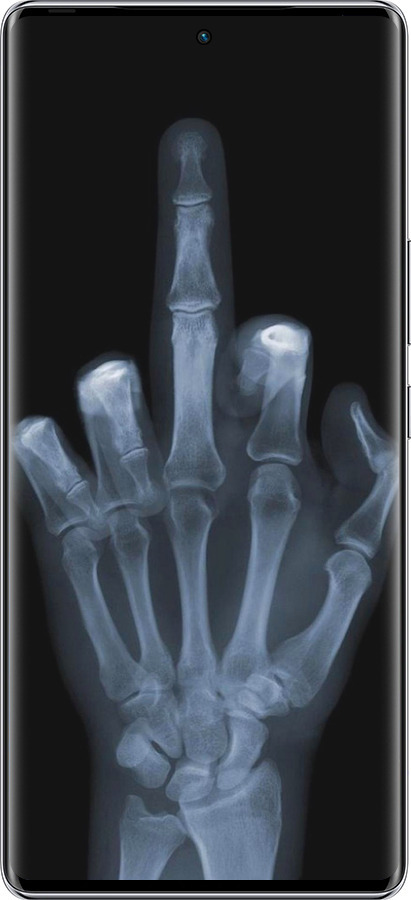 Силиконовый чехол Рука через рентген для Infinix Zero 40 5G - 1007u-3822 изображение 