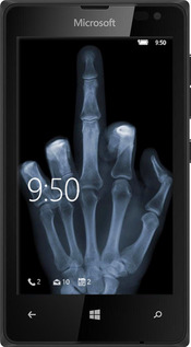 Силіконовий чехол Рука через рентген для Microsoft Lumia 435 - 1007u-673 изображение 