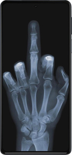 Силиконовый чехол Рука через рентген для Motorola Edge 30 Pro - 1007u-2826 изображение 