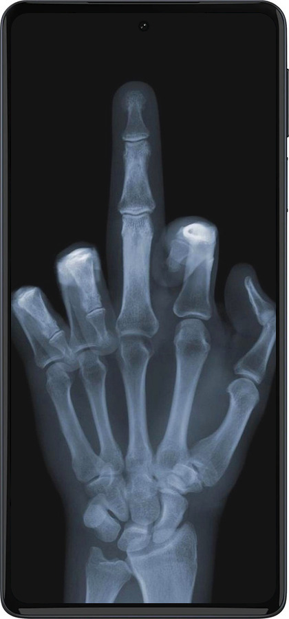 Силиконовый чехол Рука через рентген для Motorola Edge 30 Pro - 1007u-2826 изображение 