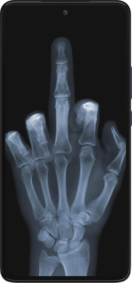 Силіконовий чехол Рука через рентген для Motorola Edge 30 - 1007u-2840 изображение 