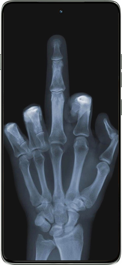 Силиконовый чехол Рука через рентген для Motorola Edge 60 Pro 5G - 1007u-4020 изображение 