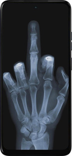 Силіконовий чехол Рука через рентген для Motorola Moto G05 - 1007u-3949 изображение 