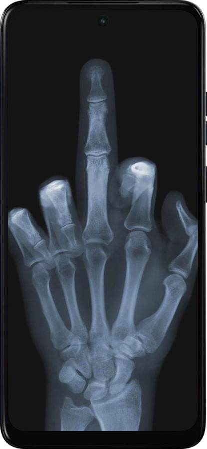 Силіконовий чехол Рука через рентген для Motorola Moto G05 - 1007u-3949 изображение 