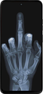 Силіконовий чехол Рука через рентген для Motorola Moto G15 Power - 1007u-4044 изображение 