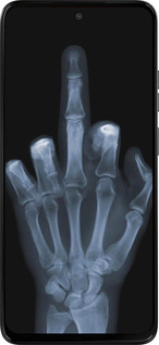 Силиконовый чехол Рука через рентген для Motorola Moto G15 - 1007u-3948 изображение 