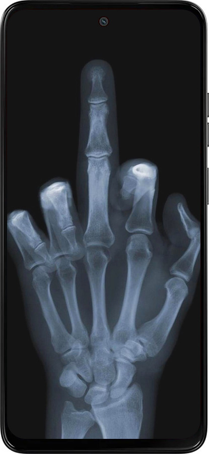 Силиконовый чехол Рука через рентген для Motorola Moto G15 - 1007u-3948 изображение 