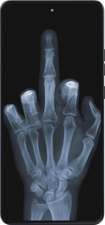 Силиконовый чехол Рука через рентген для Motorola Moto G86 - 1007u-4115 изображение 