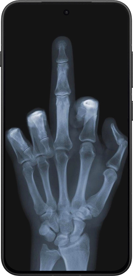 Силіконовий чехол Рука через рентген для OnePlus 13T 5G / 13S 5G - 1007u-4026 изображение 