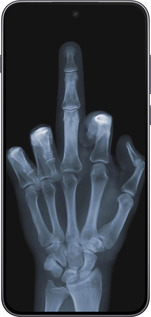 Силиконовый чехол Рука через рентген для OnePlus Nord 5 5G - 1007u-4133 изображение 