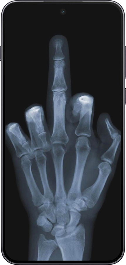 Силиконовый чехол Рука через рентген для OnePlus Nord 5 5G - 1007u-4133 изображение 