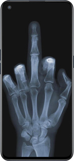 Силиконовый чехол Рука через рентген для OnePlus Nord CE 5G/CORE Edition 5G - 1007u-3484 изображение 