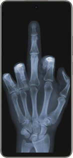 Силиконовый чехол Рука через рентген для Oppo A5 PRO - 1007u-3956 изображение 