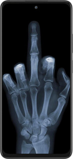 Силіконовий чехол Рука через рентген для Oppo A3 Pro 5G - 1007u-4144 изображение 