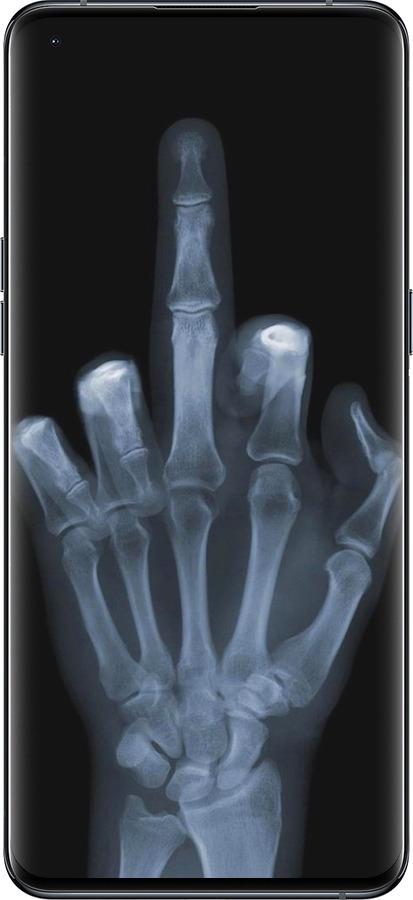 Силиконовый чехол Рука через рентген для Oppo Find X5 Pro - 1007u-2603 изображение 