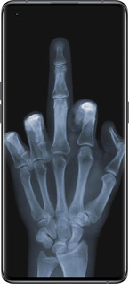 Силіконовий чехол Рука через рентген для Oppo Find X5 - 1007u-2602 изображение 