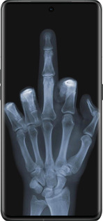 Силіконовий чехол Рука через рентген для Oppo Find X6 Pro - 1007u-3041 изображение 