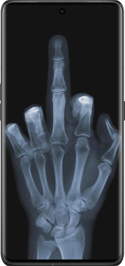 Силіконовий чехол Рука через рентген для Oppo Find X6 Pro - 1007u-3041 изображение 