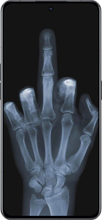 Силиконовый чехол Рука через рентген для Oppo Reno8 Pro 5G - 1007u-2615 изображение 