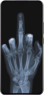 TPU чехол Рука через рентген для Oppo Reno12 Pro 5G - 1007b-3740 изображение 