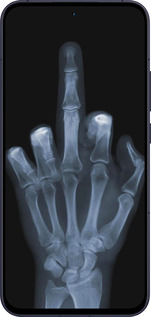 Силіконовий чехол Рука через рентген для Oppo Reno13 5G - 1007u-3944 изображение 