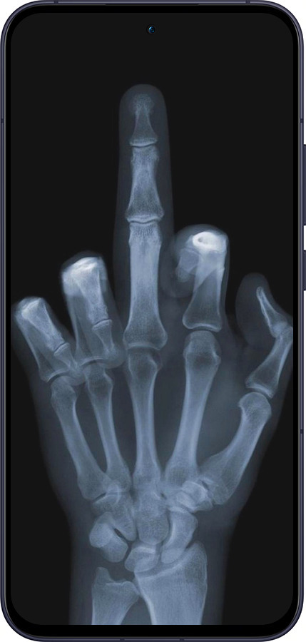 Силіконовий чехол Рука через рентген для Oppo Reno13 5G - 1007u-3944 изображение 