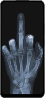 Силіконовий чехол Рука через рентген для Oppo Reno13 F 5G / Reno13 F 4G - 1007u-3955 изображение 