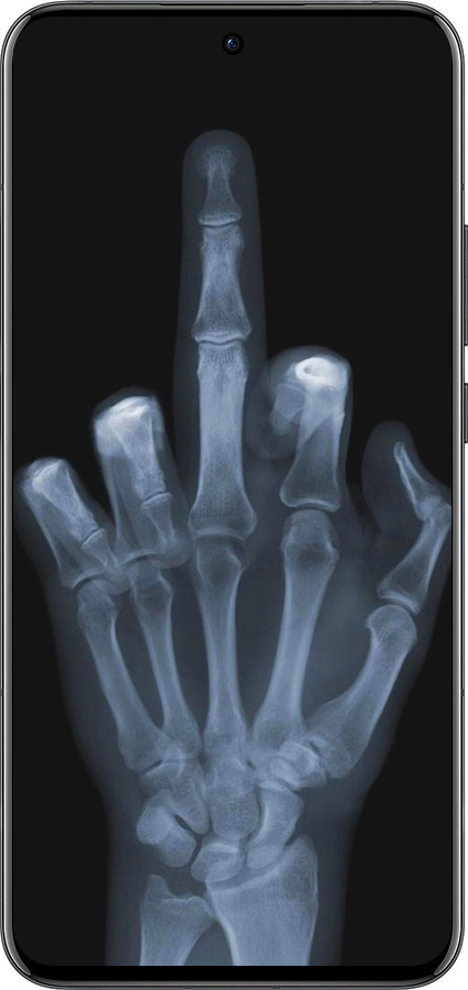 Силиконовый чехол Рука через рентген для Oppo Reno13 Pro - 1007u-3943 изображение 