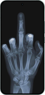 Силіконовий чехол Рука через рентген для Oppo RENO14 5G - 1007u-4058 изображение 