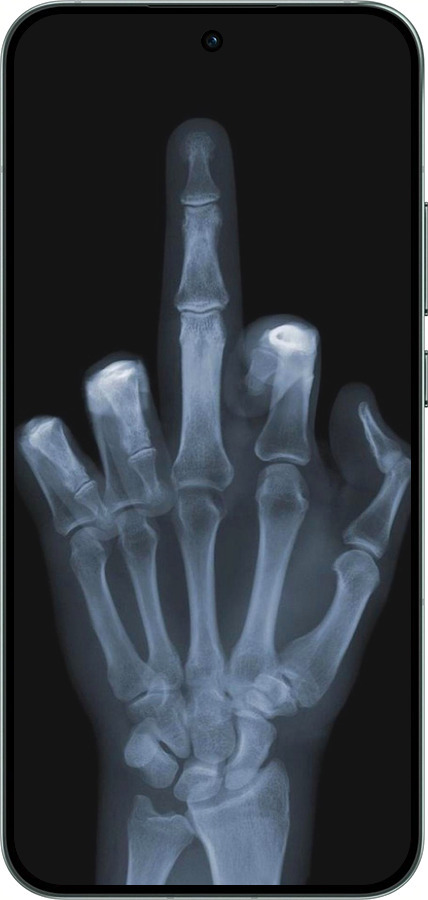 Силіконовий чехол Рука через рентген для Oppo RENO14 5G - 1007u-4058 изображение 