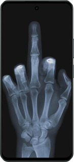 Силіконовий чехол Рука через рентген для Realme C71 - 1007u-4089 изображение 