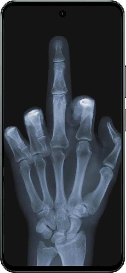 Силіконовий чехол Рука через рентген для Realme C71 - 1007u-4089 изображение 