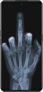 Силиконовый чехол Рука через рентген для Realme GT Neo3 - 1007u-2590 изображение 