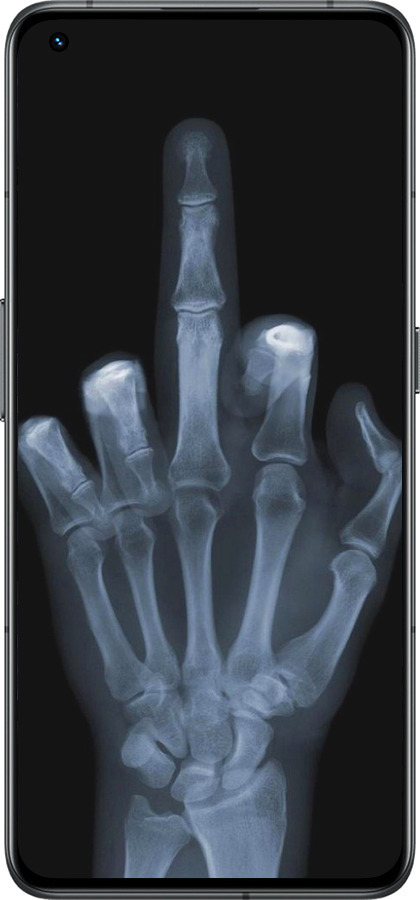 Силіконовий чехол Рука через рентген для Realme GT2 Pro - 1007u-2566 изображение 