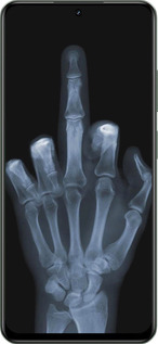 TPU чехол Рука через рентген для Realme Realme 12 5G - 1007b-3705 изображение 