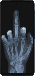 Силиконовый чехол Рука через рентген для Samsung Galaxy A06 4G - 1007u-3776 изображение 