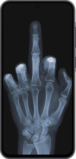 Силиконовый чехол Рука через рентген для Samsung Galaxy A36 - 1007u-3836 изображение 