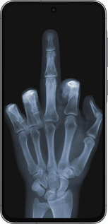 TPU чехол Рука через рентген для Samsung Galaxy A56 - 1007b-3882 изображение 