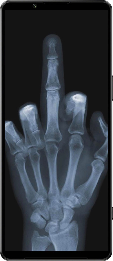 Силиконовый чехол Рука через рентген для Sony Xperia 1 IV - 1007u-2787 изображение 