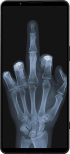 Силиконовый чехол Рука через рентген для Sony Xperia 1 VI - 1007u-3975 изображение 