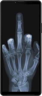 Силиконовый чехол Рука через рентген для Sony Xperia 10 IV - 1007u-2789 изображение 