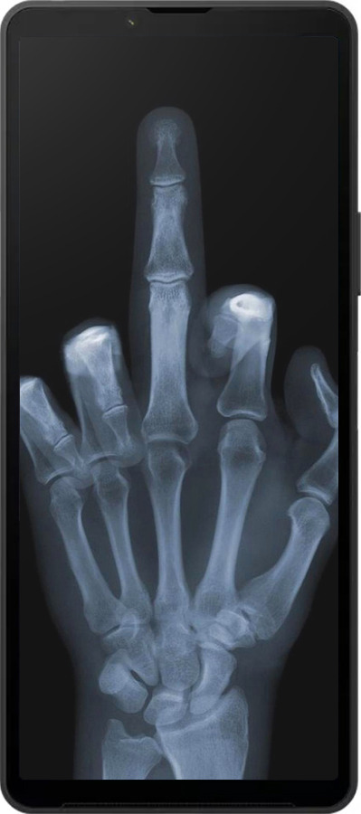 Силиконовый чехол Рука через рентген для Sony Xperia 10 VI - 1007u-3976 изображение 