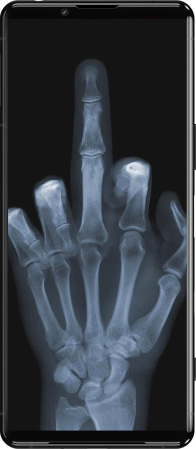 Силиконовый чехол Рука через рентген для Sony Xperia 5 III - 1007u-2580 изображение 