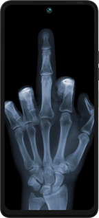 Силіконовий чехол Рука через рентген для Tecno Pova 5 - 1007u-3139 изображение 